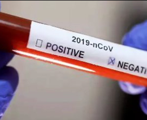 2 nouveaux cas 2 guéris et 1 décès
