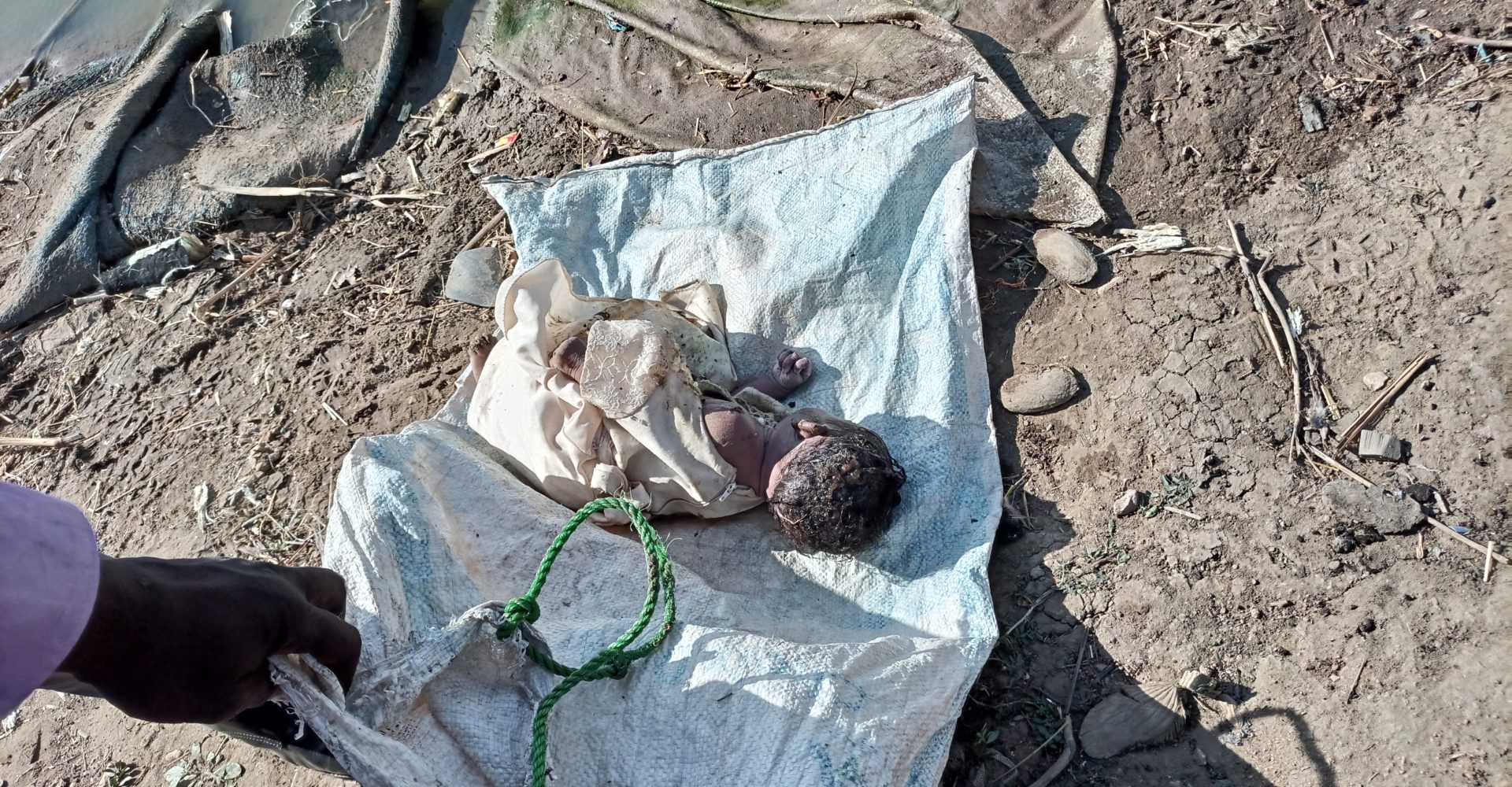 Un nouveau-né, jeté dans le bassin de rétention d’Abena 1