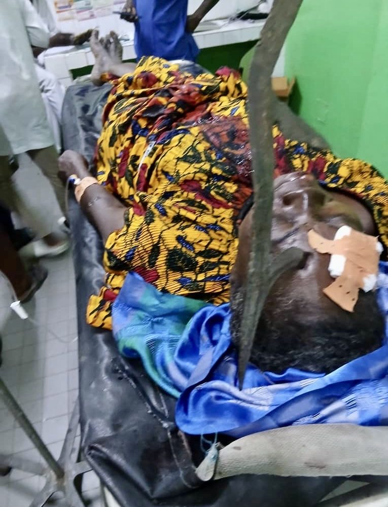 Sarh : Un sexagénaire blesse grièvement à l’œil son épouse au quartier Kamati 1 Sarh : Un sexagénaire blesse grièvement à l’œil son épouse au quartier Kamati 1