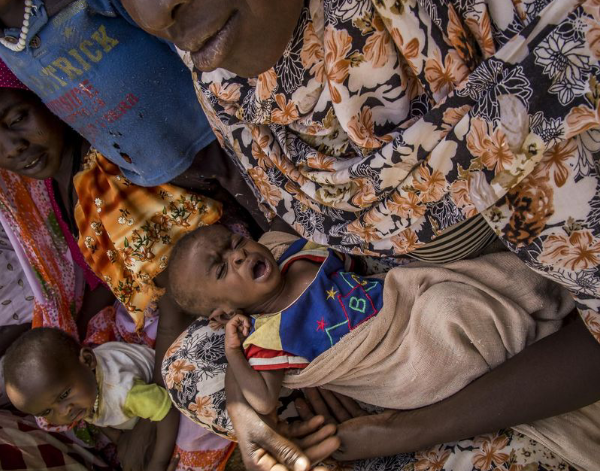 5,9 millions de personnes n’ont pas accès à une alimentation saine, 4,4 millions d’autres souffrent de malnutrition cette année au Tchad