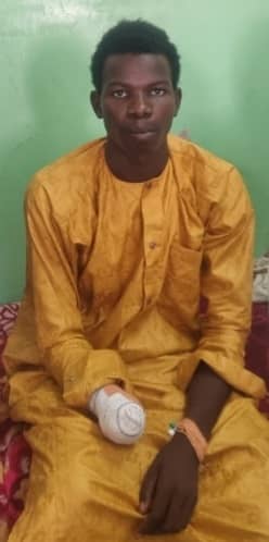 La Ctddh exige une enquête pour l’amputation de la main d’Hisseine Abdoulaye