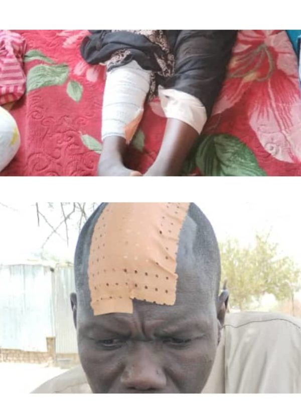 Insécurité: un père de famille et sa fille blessés par des bandits à pont-Belilé