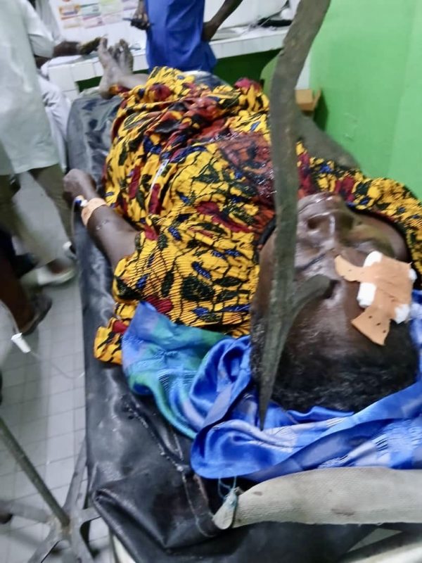 Sarh : Un sexagénaire blesse grièvement à l’œil son épouse au quartier Kamati