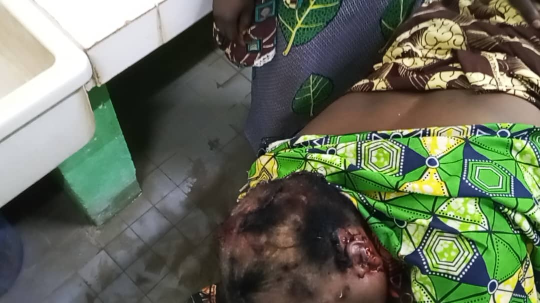 Sarh : une femme violemment agressée par son fils 1 Sarh : une femme violemment agressée par son fils 1